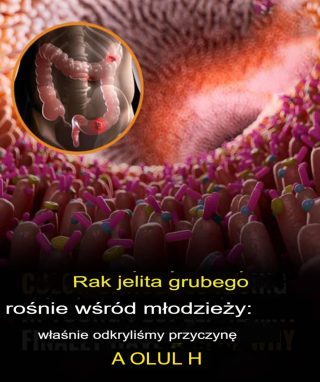 W końcu mamy odpowiedź na rosnącą liczbę zachorowań na raka jelita grubego wśród młodych dorosłych