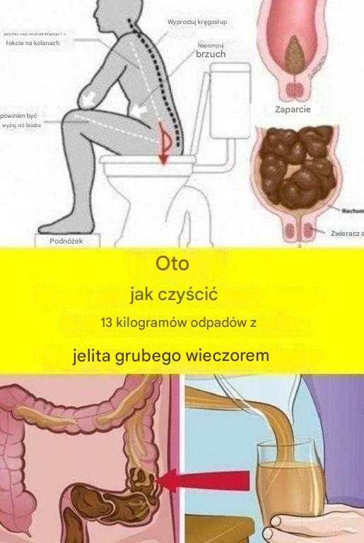 Zaparcia: Oto 3 naturalne sposoby, które ułatwiają wypróżnianie, według dietetyka