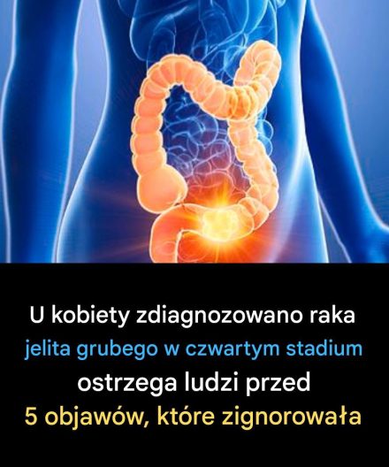 Kobieta ujawnia 5 objawów raka jelita grubego, których nie należy ignorować