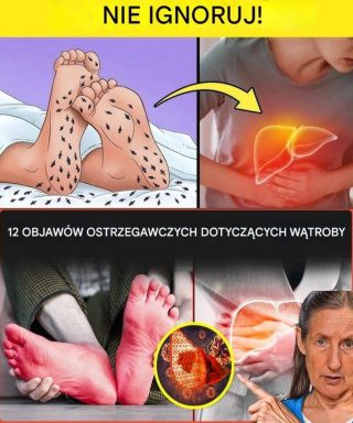 Co Twoje Stopy Mogą Ci Powiedzieć O Twoim Zdrowiu: Na Co Należy Zwracać Uwagę, W Tym Problemy Z Wątrobą