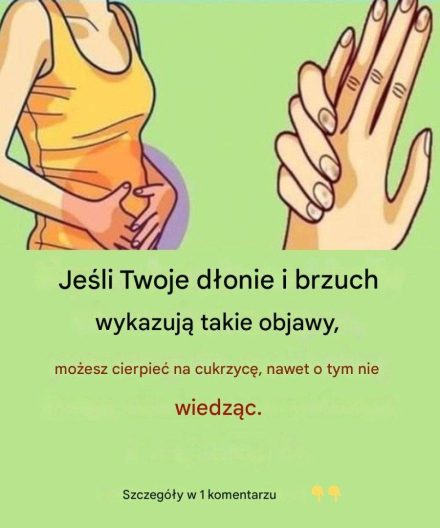 Jeśli zauważysz te objawy na rękach i brzuchu, możesz cierpieć na cukrzycę, nawet o tym nie wiedząc.