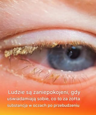 Ludzie są zaniepokojeni, gdy uświadamiają sobie, co to za żółta substancja w oczach po przebudzeniu