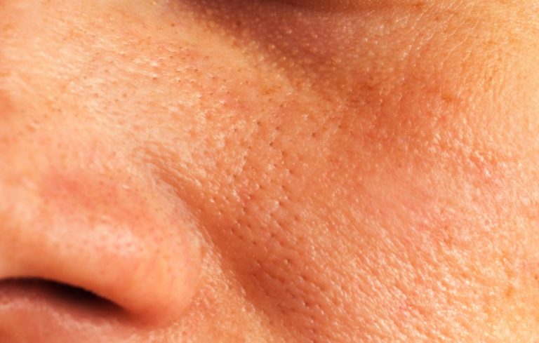 Jak zmniejszyć widoczność porów – kompletny poradnik pielęgnacji