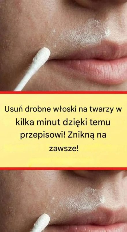 Ta naturalna receptura na stałe usunie włoski z twarzy
