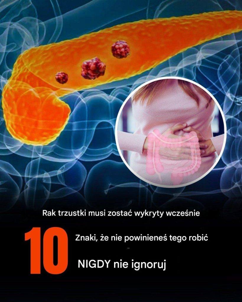 Rak trzustki wymaga wczesnego leczenia. Objawy, na które należy zwrócić uwagę