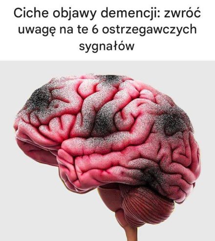 Ciche objawy demencji: zwróć uwagę na te 6 ostrzegawczych sygnałów