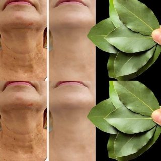 Liść laurowy jest 100 000 razy silniejszy niż botoks? | Naturalny środek na zmarszczki nawet w wieku 70 lat!