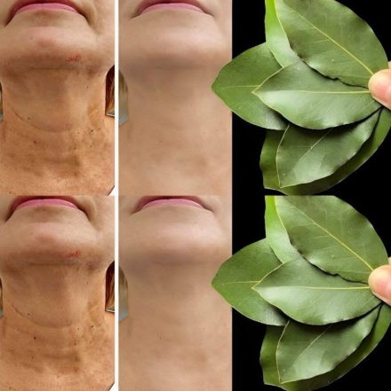 Liść laurowy jest 100 000 razy silniejszy niż botoks? | Naturalny środek na zmarszczki nawet w wieku 70 lat!
