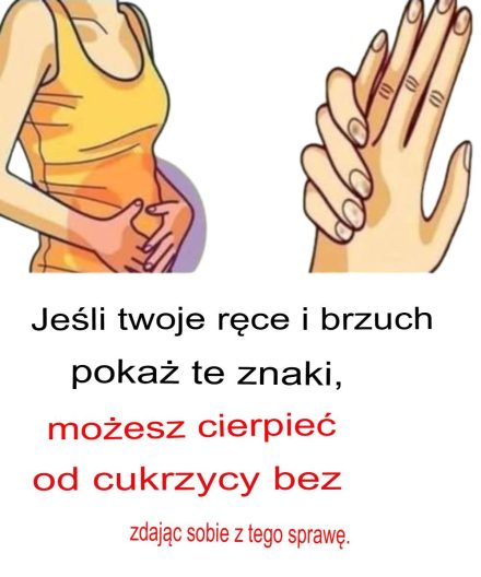 Jeśli Twoje dłonie i brzuch wykazują takie objawy, możesz cierpieć na cukrzycę, nie zdając sobie z tego sprawy