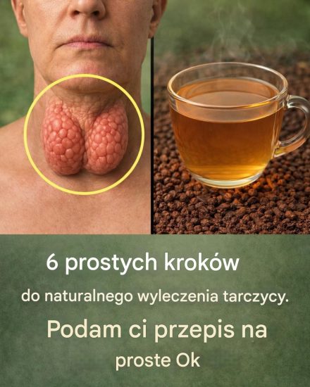 6 prostych kroków, aby naturalnie wspierać zdrowie tarczycy