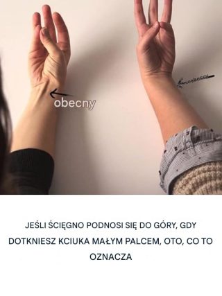 Jeśli ścięgno unosi się podczas dotyku: Zrozumienie zjawiska