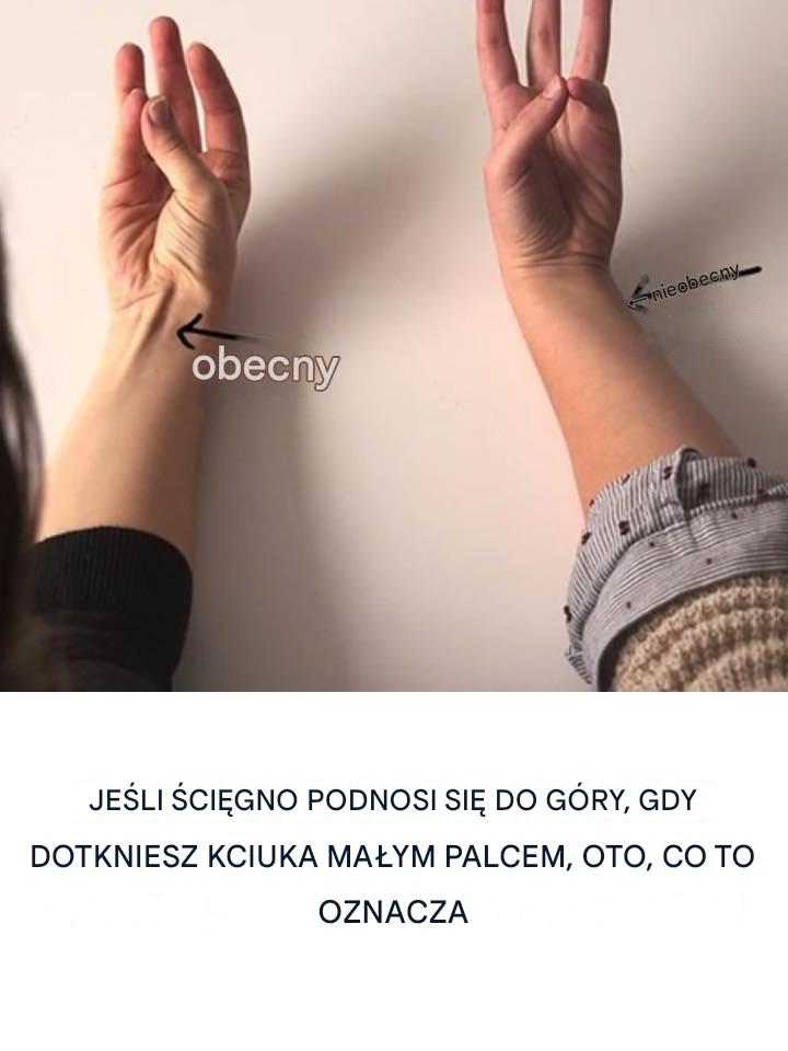 Jeśli ścięgno unosi się podczas dotyku: Zrozumienie zjawiska