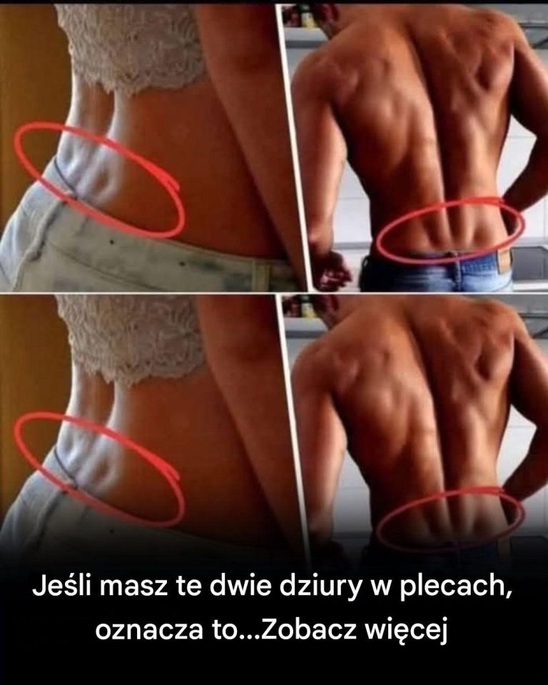 Jeśli masz te dwa „dołeczki” w dolnej części pleców, oto co one oznaczają