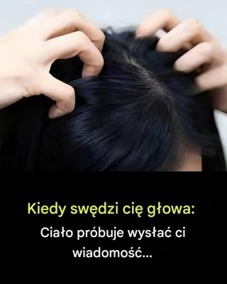 Swędząca skóra głowy? Oto najczęstsze przyczyny.