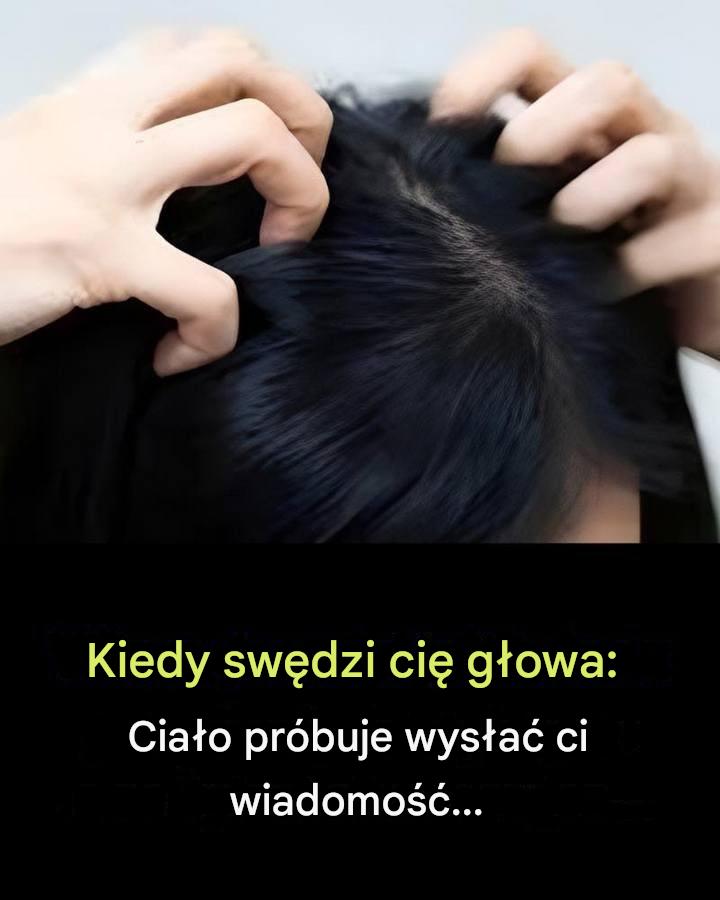 Swędząca skóra głowy? Oto najczęstsze przyczyny.