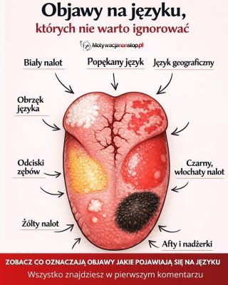 Objawy na języku, których nie warto ignorować – co mogą oznaczać i jak sobie pomóc