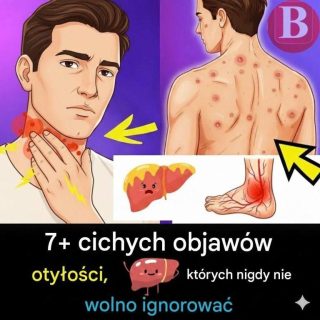 Co powinieneś wiedzieć o stłuszczeniu wątroby – przyczyny, objawy i sposoby leczenia