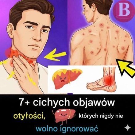 Co powinieneś wiedzieć o stłuszczeniu wątroby – przyczyny, objawy i sposoby leczenia