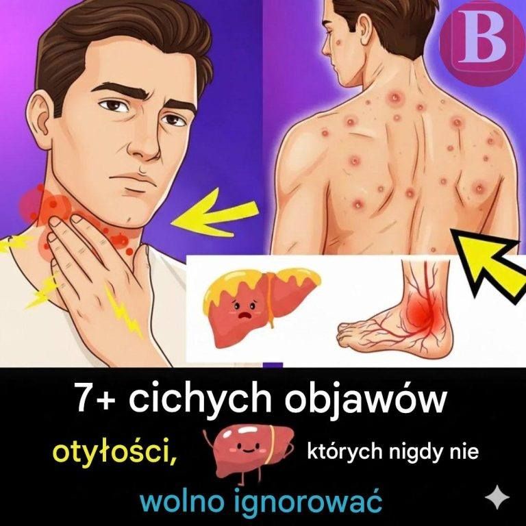 Co powinieneś wiedzieć o stłuszczeniu wątroby – przyczyny, objawy i sposoby leczenia